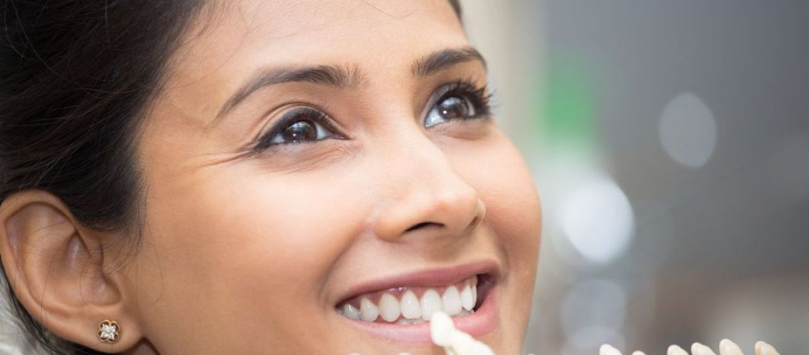 Feature Image 2 - Veneers