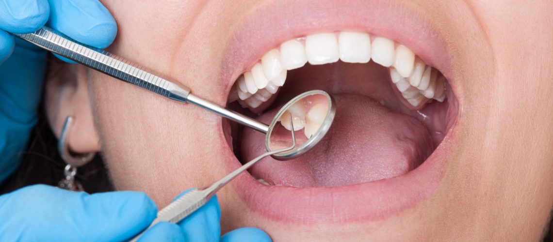Dentist tools and mouth open with beautiful teeth